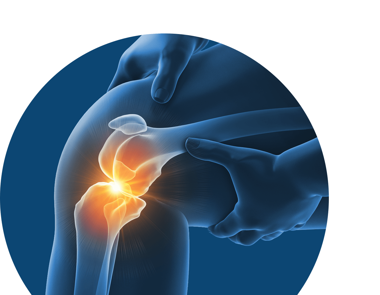 Painful knee area (CG anatomy)